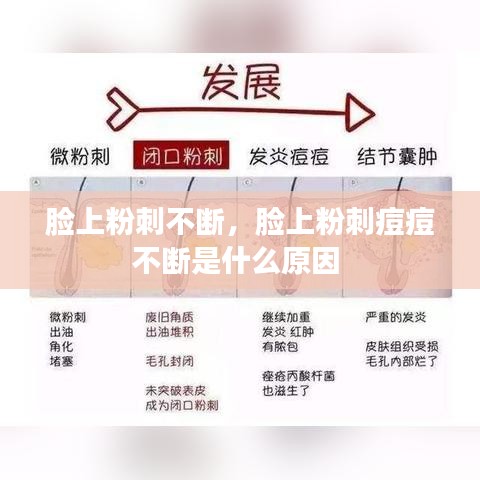 臉上粉刺不斷，臉上粉刺痘痘不斷是什么原因 