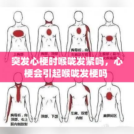 突發(fā)心梗時喉嚨發(fā)緊嗎，心梗會引起喉嚨發(fā)梗嗎 