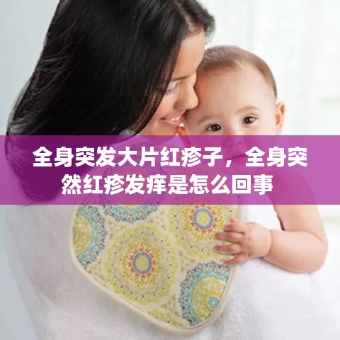 全身突發(fā)大片紅疹子，全身突然紅疹發(fā)癢是怎么回事 