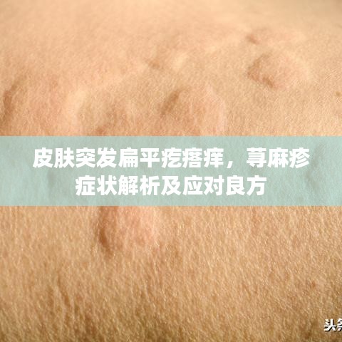 皮膚突發(fā)扁平疙瘩癢，蕁麻疹癥狀解析及應(yīng)對良方
