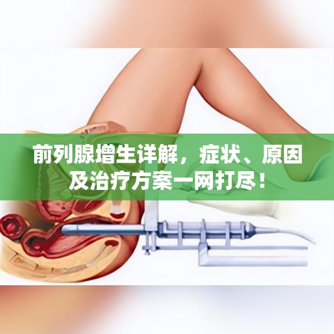 前列腺增生詳解，癥狀、原因及治療方案一網(wǎng)打盡！