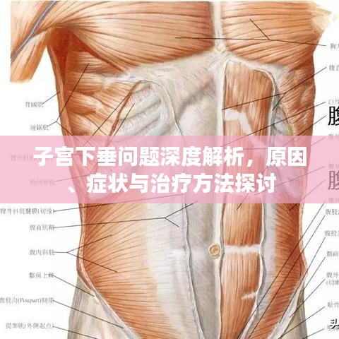 子宮下垂問(wèn)題深度解析，原因、癥狀與治療方法探討