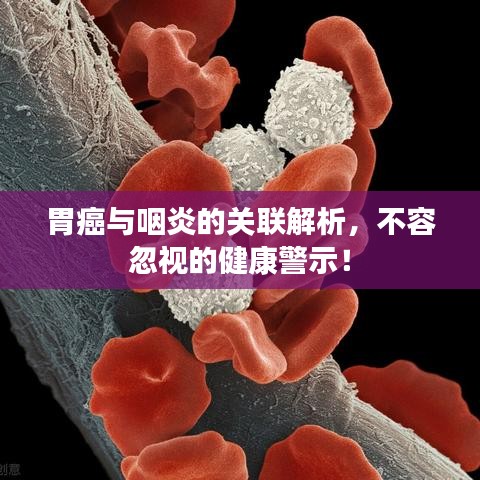 胃癌與咽炎的關(guān)聯(lián)解析，不容忽視的健康警示！